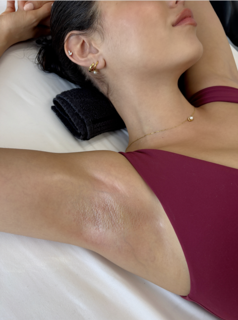 showcase of underarm after removal when discussing how often you should get sugared at bloom sugaring in ocean park santa monica